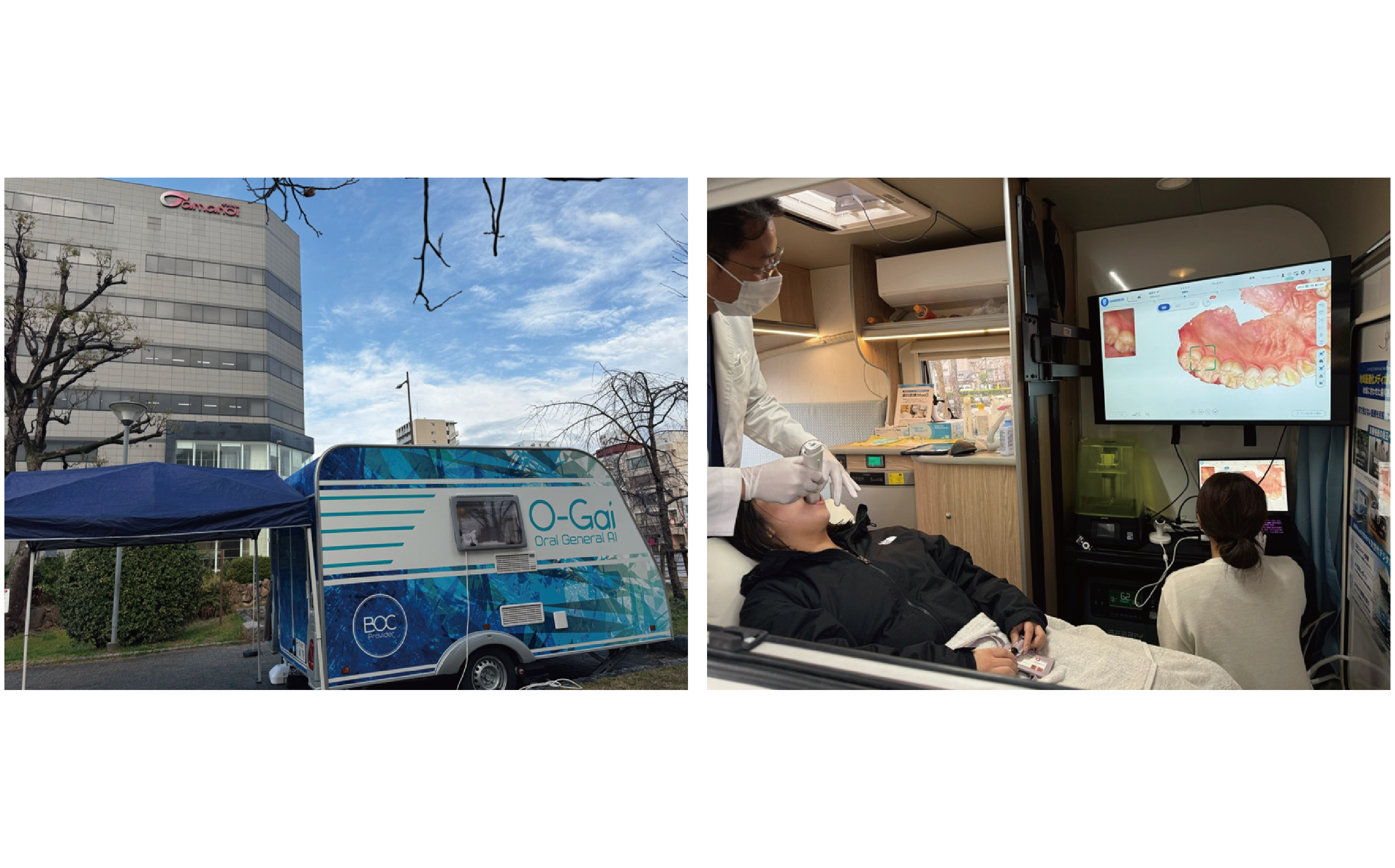 【実施レポート】「健康経営」を推進するタマノイ酢 オーガイ・堺市と連携し、移動型歯科検診の実証実験に参加 ～社内ジム・社内医育成など独自の健康習慣に「歯科検診」を加え、従業員の健康寿命延伸へ～